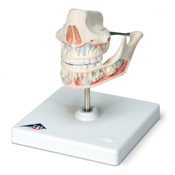 Milk Denture Model with Remaining Teeth -