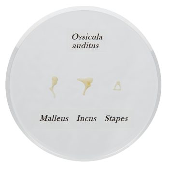 ossicleears-medstore.ie