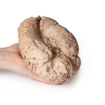 brainmodels-medstore.ie