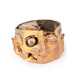 anatomicalmodels-medstore.ie