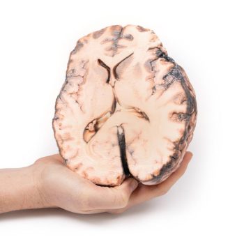 brainmodels-medstore.ie