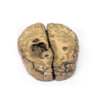 anatomicalmodels-medstore.ie