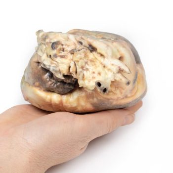 anatomicalmodels-medstore.ie