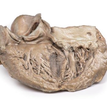 anatomicalmodels-medstore.ie