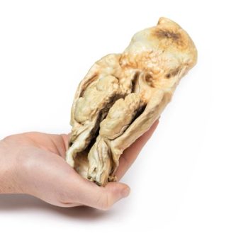 anatomicalmodels-medstore.ie