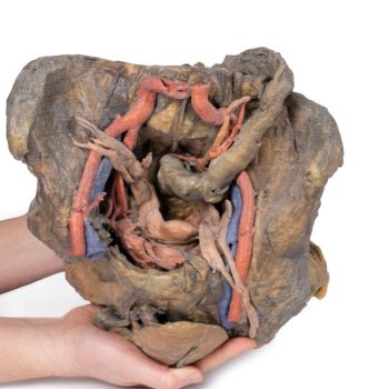 femalepelvis-medstore.ie