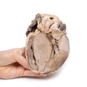 heartmodels-medstore.ie