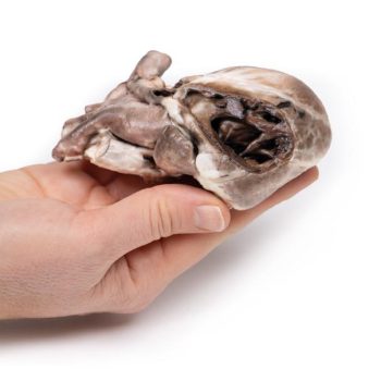 heartmodels-medstore.ie