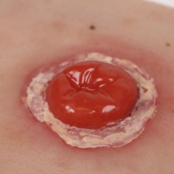 colostomy-medstore.ie