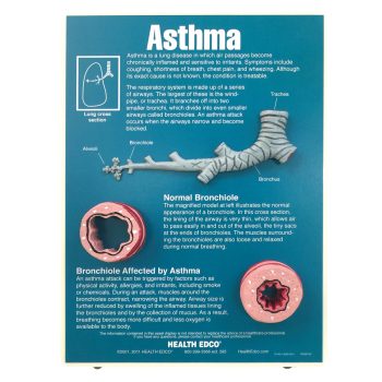 asthmamodels-medstore.ie