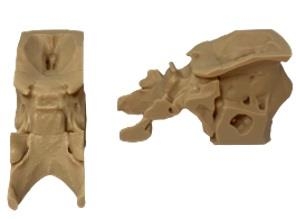 Endonasal drilling-medstore.ie