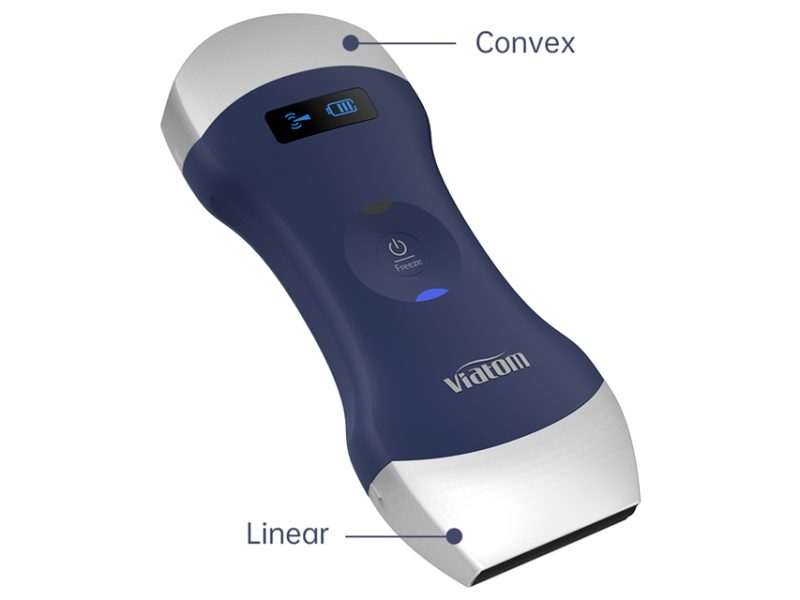 WIRELESS HANDHELD ULTRASOUND SCANNERS – Medstore