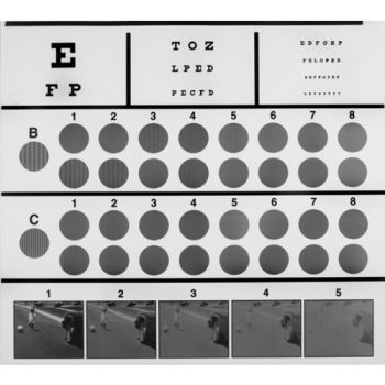 opthalmoscopes-medstore.ie