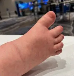 downsyndrome models ireland