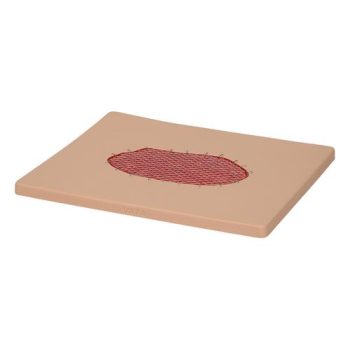 Skin graft wound board light