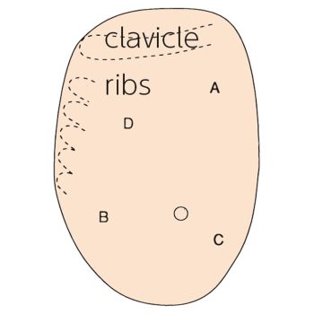 Visual Tactile Breast Examination Simulator