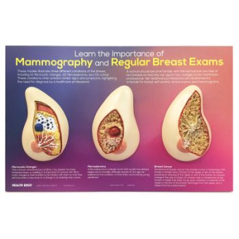 Learn The Importance of Mammography Display