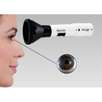 The New Iriscope Wireless Edition