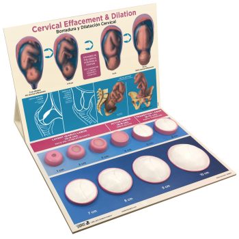 Cervical Effacement & Dilation Model