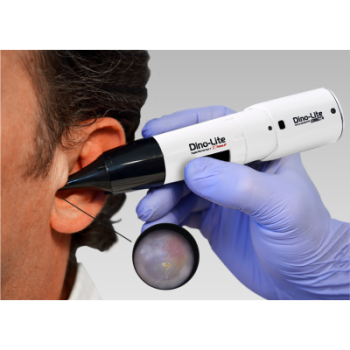 Ear Scope Professional Wireless
