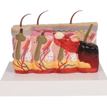 Pathological skin model with burns, 30 times size