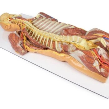 Posterior Body Wall / Ventral Deep Dissection