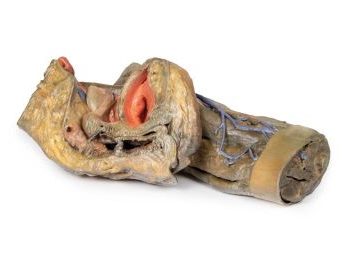 Female hemipelvis and thigh