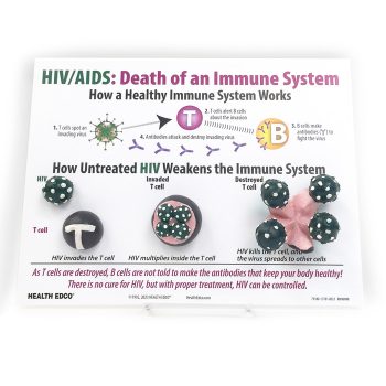 HIV Aids The Death of an Immune System Easel