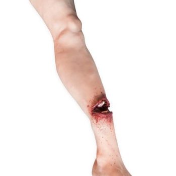 Leg Open Fracture for ADAM -X Series manikin