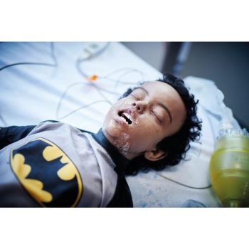 Toddler Chest Trauma 3yr Old Dark Skin/Male Version