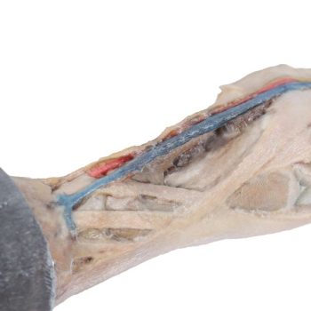 Horse foot - tendons, ligaments, vessels and nerves