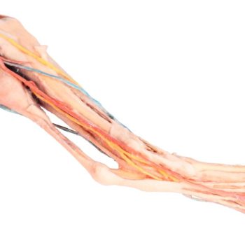 Dog hindlimb- muscles, tendons, ligaments, vessels and nerves distal to the stifle"