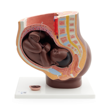 Pregnancy Pelvis Model in Median Section with Removable Fetus (40 weeks), 3 part, dark skin -