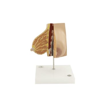 Mammary Gland of a Nursing Woman