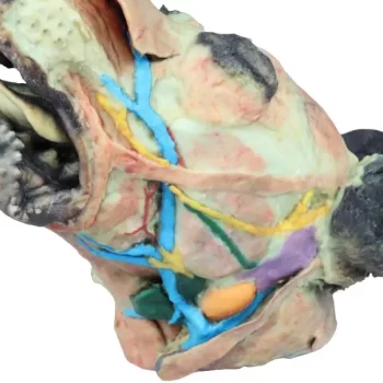 Dog Head Superficial and Deep Dissections