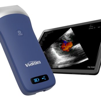 New: Wireless Handheld Ultrasound Scanners
