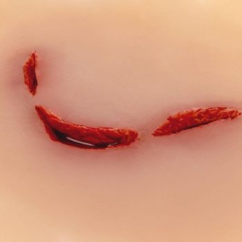 Wound moulage cut broken bottle"