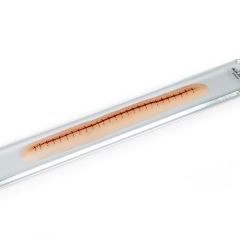 Surgical wound with staples, 22cm