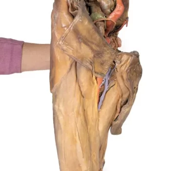Male hemipelvis and thigh