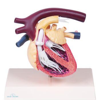 Canine Heart with Heartworm