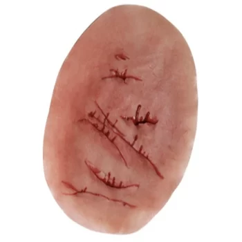 Multiple incision wound