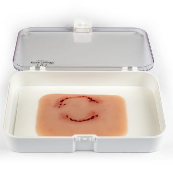 Wound moulage "human bite