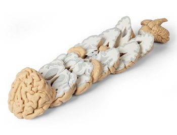 Human Brain Multiple Frontal Sections"