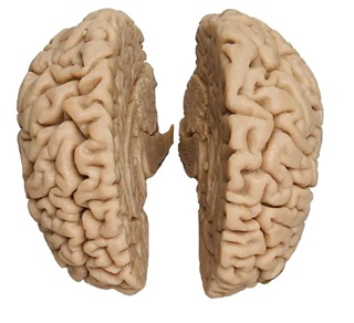 Human Brain, actual cast"