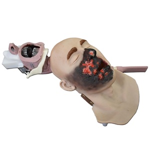 Burn Victim Burn Kit
