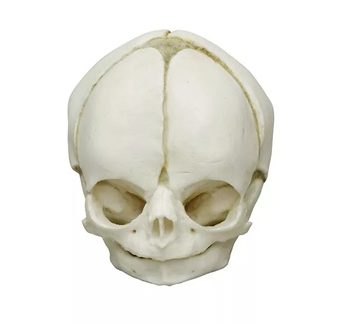 Fetal skull 29 weeks"
