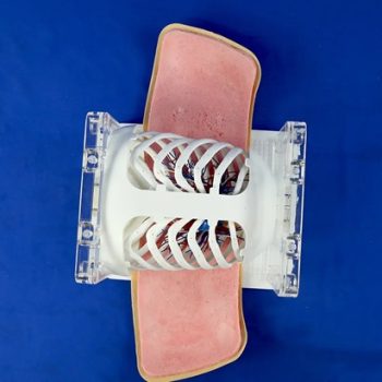 Lung Nodule Puncture Model