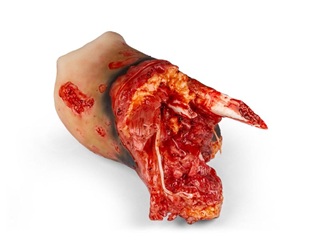 Right Amputatin Stump for Combat Carl