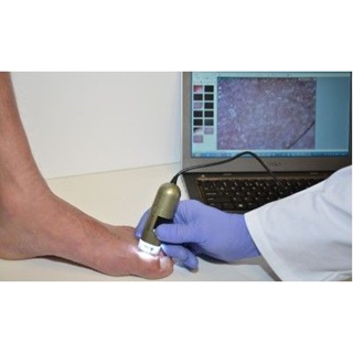Podoscope
