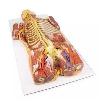 A New way of Looking at Anatomical Models: Posterior Body Wall / Ventral Deep Dissection